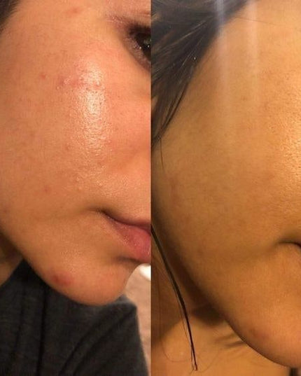 ACURE Brightening Facial Scrub
