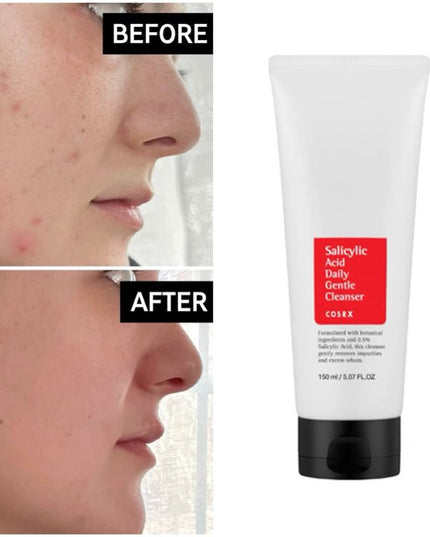 Cosrx Salicylic Acid Daily Gentle Cleanser