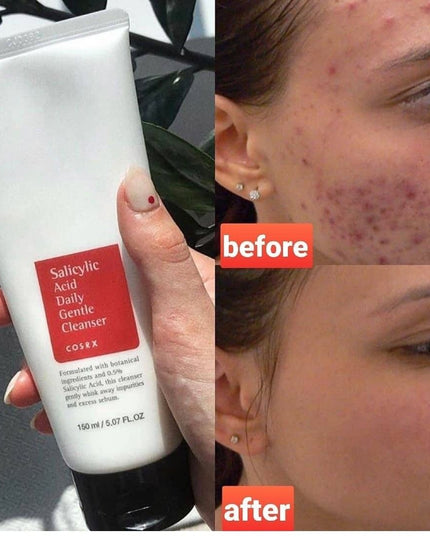 Cosrx Salicylic Acid Daily Gentle Cleanser